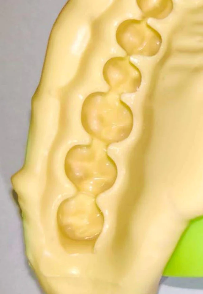 Biokalgin Chromatic Pro Alginate Impression Material 453 gm - Image 2