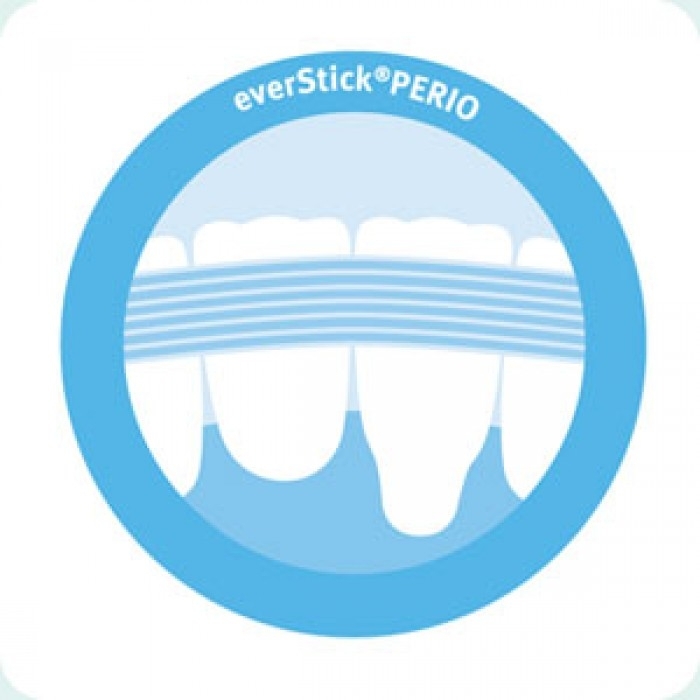 GC EverStick Perio - Image 2